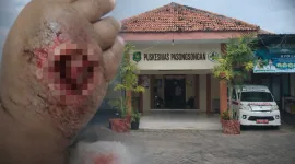 Foto: Kondisi tangan pasien usai pemasangan infus dan tampak depan Puskesmas Pasongsongan, Sumenep.
